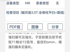 肺癌术后五年，脑膜转移治疗三年，伏美替尼6粒，脊膜转移，脑萎缩